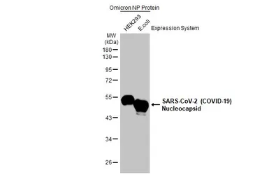 Anti-SARS-CoV-2 (COVID-19) Nucleocapsid antibody [HL448] used in Western Blot (WB). GTX635686