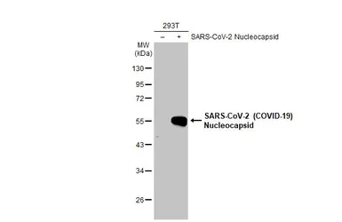 Anti-SARS-CoV-2 (COVID-19) Nucleocapsid antibody [HL448] used in Western Blot (WB). GTX635686