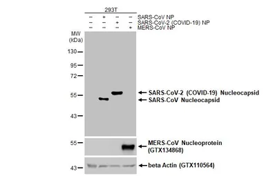 Anti-SARS-CoV-2 (COVID-19) Nucleocapsid antibody [HL453] used in Western Blot (WB). GTX635687