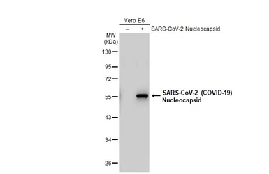 Anti-SARS-CoV-2 (COVID-19) Nucleocapsid antibody [HL453] used in Western Blot (WB). GTX635687