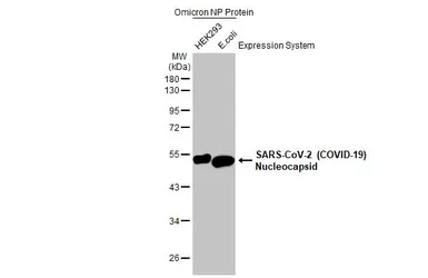 Anti-SARS-CoV-2 (COVID-19) Nucleocapsid antibody [HL453] used in Western Blot (WB). GTX635687