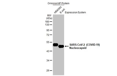 Anti-SARS-CoV-2 (COVID-19) Nucleocapsid antibody [HL455] used in Western Blot (WB). GTX635688