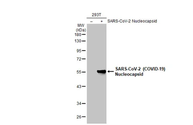 Anti-SARS-CoV-2 (COVID-19) Nucleocapsid antibody [HL455] used in Western Blot (WB). GTX635688