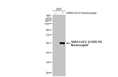 Anti-SARS-CoV-2 (COVID-19) Nucleocapsid antibody [HL455] used in Western Blot (WB). GTX635688