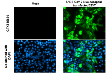 Anti-SARS-CoV-2 (COVID-19) Nucleocapsid antibody [HL5511] used in Immunocytochemistry/ Immunofluorescence (ICC/IF). GTX635689