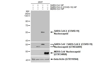 Anti-SARS-CoV-2 (COVID-19) Nucleocapsid antibody [HL5511] used in Western Blot (WB). GTX635689