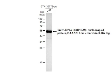 Anti-SARS-CoV-2 (COVID-19) Nucleocapsid antibody [HL5511] used in Western Blot (WB). GTX635689