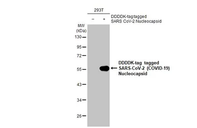 Anti-SARS-CoV-2 (COVID-19) Nucleocapsid antibody [HL5511] used in Western Blot (WB). GTX635689