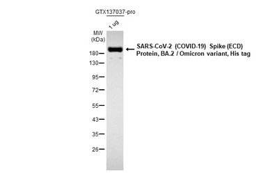 Anti-SARS-CoV-2 (COVID-19) Spike RBD antibody [HL257] used in Western Blot (WB). GTX635692