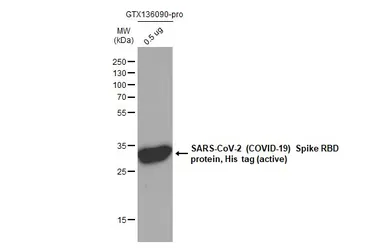 Anti-SARS-CoV-2 (COVID-19) Spike RBD antibody [HL257] used in Western Blot (WB). GTX635692