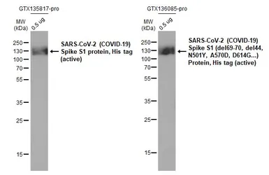 Anti-SARS-CoV-2 (COVID-19) Spike RBD antibody [HL257] used in Western Blot (WB). GTX635692