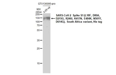 Anti-SARS-CoV-2 (COVID-19) Spike RBD antibody [HL257] used in Western Blot (WB). GTX635692