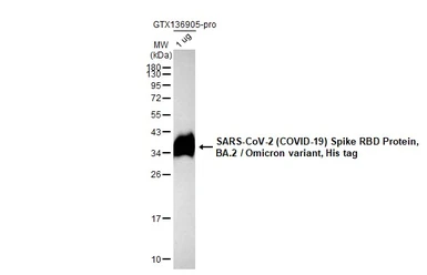 Anti-SARS-CoV-2 (COVID-19) Spike RBD antibody [HL257] used in Western Blot (WB). GTX635692