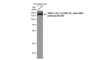 Anti-SARS-CoV-2 (COVID-19) Spike RBD antibody [HL257] used in Western Blot (WB). GTX635692