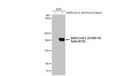 Anti-SARS-CoV-2 (COVID-19) Spike RBD antibody [HL257] used in Western Blot (WB). GTX635692