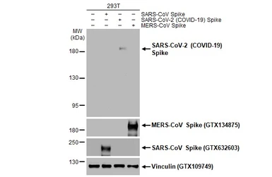 Anti-SARS-CoV-2 (COVID-19) Spike S2 antibody [HL237] used in Western Blot (WB). GTX635693