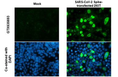 Anti-SARS-CoV-2 (COVID-19) Spike S2 antibody [HL237] used in Immunocytochemistry/ Immunofluorescence (ICC/IF). GTX635693
