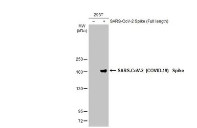 Anti-SARS-CoV-2 (COVID-19) Spike S2 antibody [HL237] used in Western Blot (WB). GTX635693