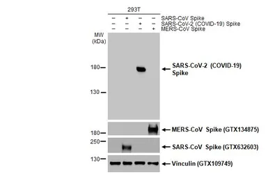 Anti-SARS-CoV-2 (COVID-19) Spike S1 antibody [GT263] used in Western Blot (WB). GTX635708