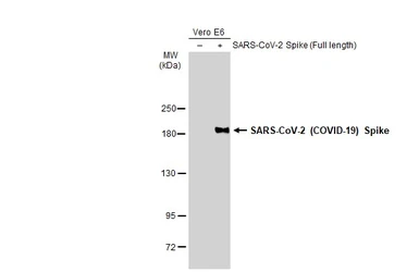 Anti-SARS-CoV-2 (COVID-19) Spike S1 antibody [GT263] used in Western Blot (WB). GTX635708