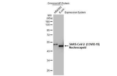 Anti-SARS-CoV-2 (COVID-19) Nucleocapsid antibody [HL455-MS] used in Western Blot (WB). GTX635712