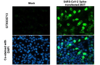 Anti-SARS-CoV-2 (COVID-19) Spike S1 antibody [HL13402] used in Immunocytochemistry/ Immunofluorescence (ICC/IF). GTX635713