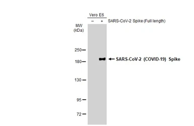 Anti-SARS-CoV-2 (COVID-19) Spike S1 antibody [HL13402] used in Western Blot (WB). GTX635713