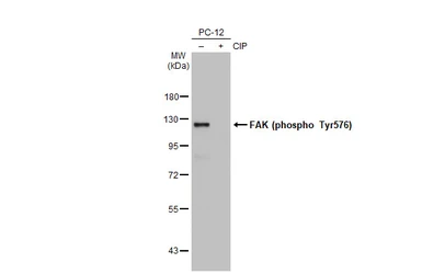 Anti-FAK (phospho Tyr576) antibody [HL127] used in Western Blot (WB). GTX635714