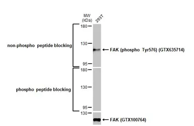 Anti-FAK (phospho Tyr576) antibody [HL127] used in Western Blot (WB). GTX635714