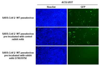 Anti-SARS-CoV-2 (COVID-19) Spike RBD antibody [HL1003] used in Neutralizing/Blocking/Inhibition (Neutralizing/Inhibition). GTX635792