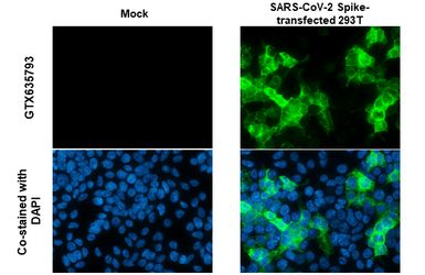 Anti-SARS-CoV-2 (COVID-19) Spike RBD antibody [HL1004] used in Immunocytochemistry/ Immunofluorescence (ICC/IF). GTX635793
