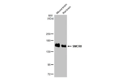 Anti-SMCR8 antibody [HL1007] used in Western Blot (WB). GTX635798