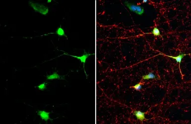 Anti-SMCR8 antibody [HL1007] used in Immunocytochemistry/ Immunofluorescence (ICC/IF). GTX635798