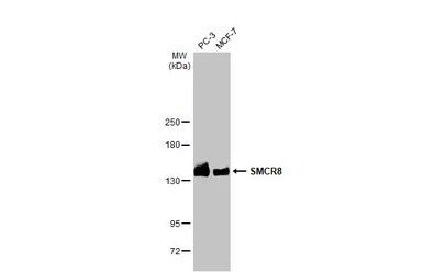 Anti-SMCR8 antibody [HL1007] used in Western Blot (WB). GTX635798