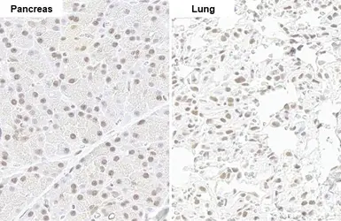 Anti-SMCR8 antibody [HL1007] used in IHC (Paraffin sections) (IHC-P). GTX635798