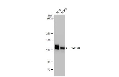 Anti-SMCR8 antibody [HL1007] used in Western Blot (WB). GTX635798