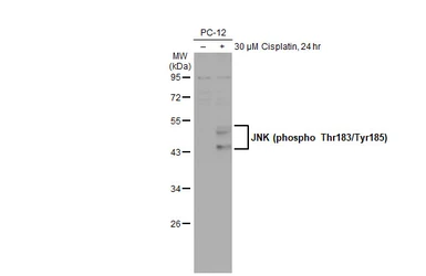 Anti-JNK (phospho Thr183/Tyr185) antibody [HL1008] used in Western Blot (WB). GTX635799