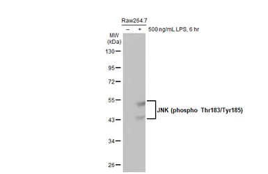 Anti-JNK (phospho Thr183/Tyr185) antibody [HL1008] used in Western Blot (WB). GTX635799