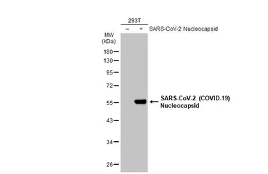 Anti-SARS-CoV-2 (COVID-19) Nucleocapsid antibody [GT113] used in Western Blot (WB). GTX635808