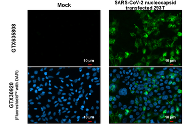 Anti-SARS-CoV-2 (COVID-19) Nucleocapsid antibody [GT113] used in Immunocytochemistry/ Immunofluorescence (ICC/IF). GTX635808
