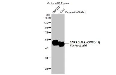 Anti-SARS-CoV-2 (COVID-19) Nucleocapsid antibody [GT113] used in Western Blot (WB). GTX635808