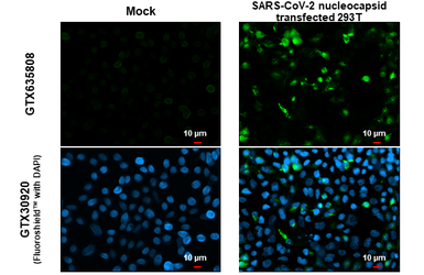 Anti-SARS-CoV-2 (COVID-19) Nucleocapsid antibody [GT113] used in Immunocytochemistry/ Immunofluorescence (ICC/IF). GTX635808