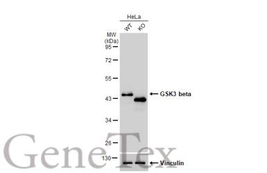 Anti-GSK3 beta antibody [GT16711] used in Western Blot (WB). GTX635816
