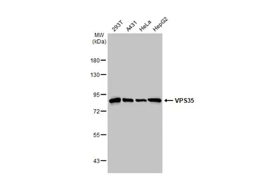 Anti-VPS35 antibody [HL1017] used in Western Blot (WB). GTX635821