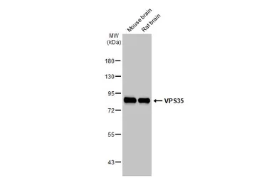 Anti-VPS35 antibody [HL1017] used in Western Blot (WB). GTX635821