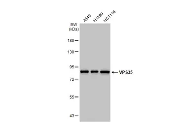 Anti-VPS35 antibody [HL1017] used in Western Blot (WB). GTX635821
