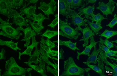 Anti-VPS35 antibody [HL1017] used in Immunocytochemistry/ Immunofluorescence (ICC/IF). GTX635821