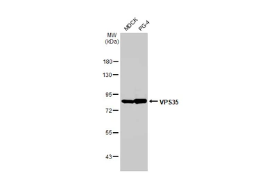 Anti-VPS35 antibody [HL1017] used in Western Blot (WB). GTX635821