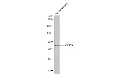 Anti-VPS35 antibody [HL1017] used in Western Blot (WB). GTX635821