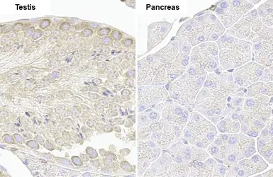 Anti-VPS35 antibody [HL1017] used in IHC (Paraffin sections) (IHC-P). GTX635821